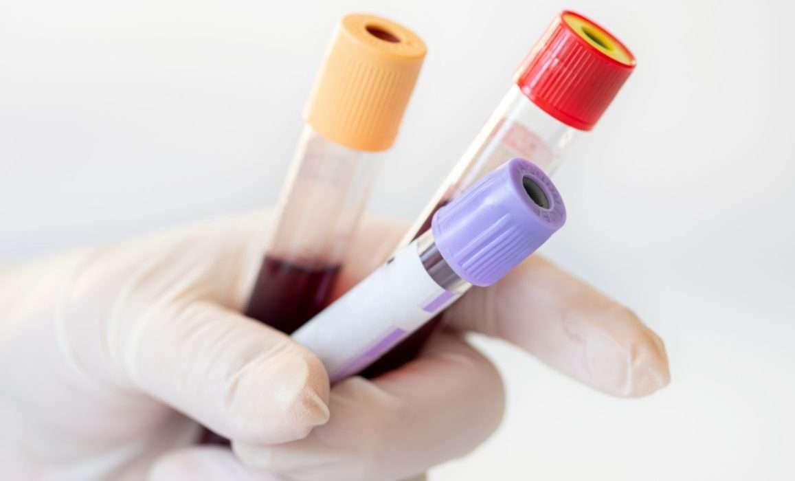 DNA Test